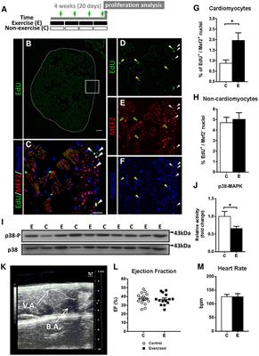 Physiological Responses to Swimming-Induced Exercise in the Adult Zebrafish Regenerating Heart